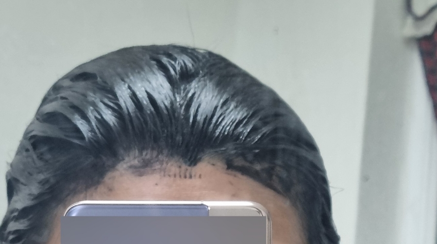 원리73 로스터스 이미지