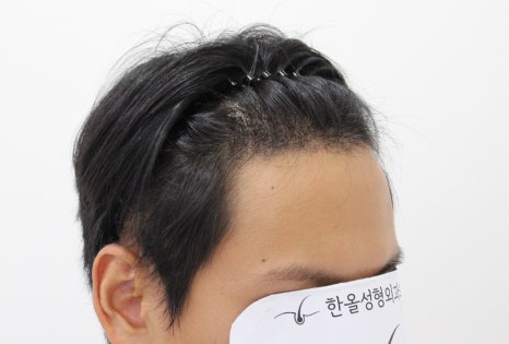 더헤어라인성형외과의원 이미지