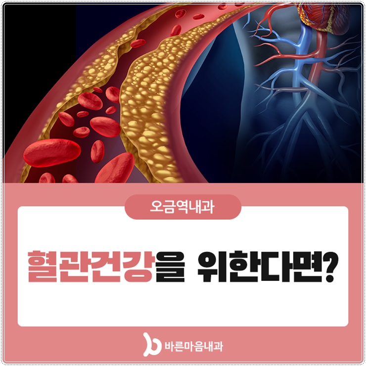 서초바른내과 이미지