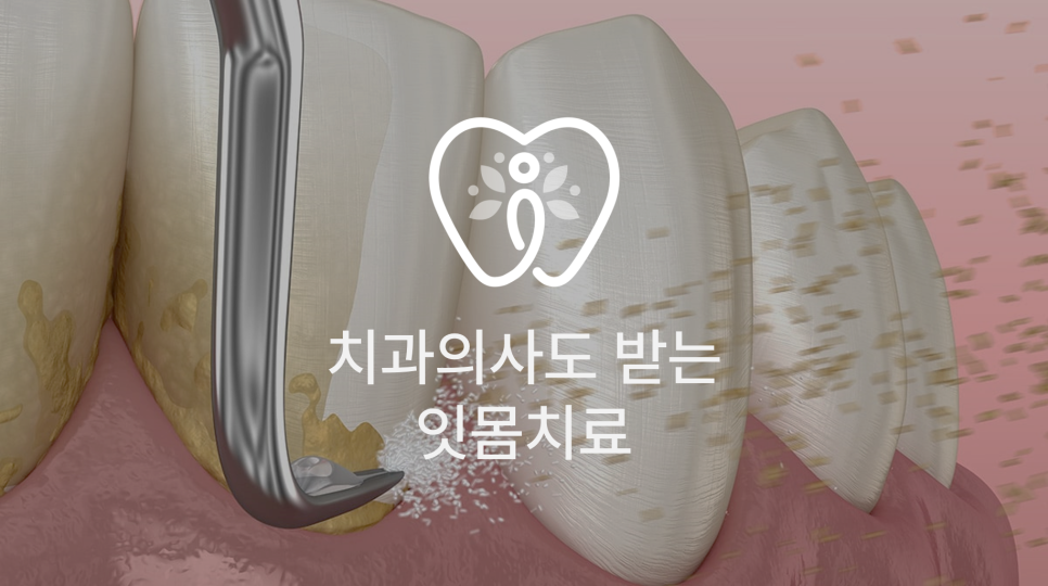 이아소치과의원 이미지