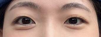 헤이니크뷰티 이미지