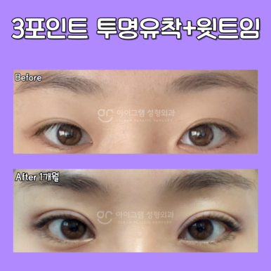 아이그램성형외과 이미지
