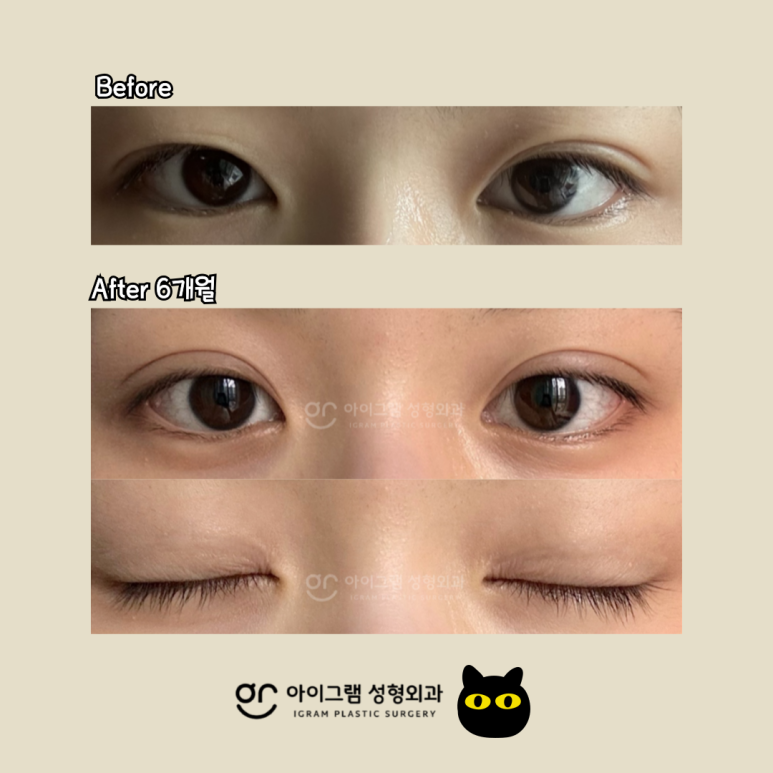 아이그램성형외과 이미지