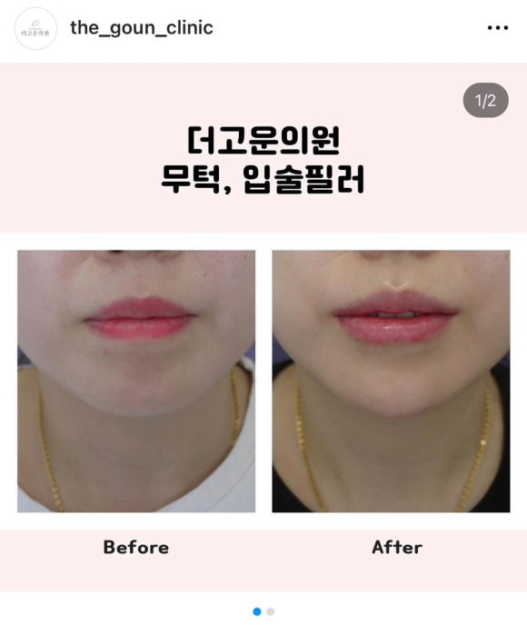 더고운의원 이미지