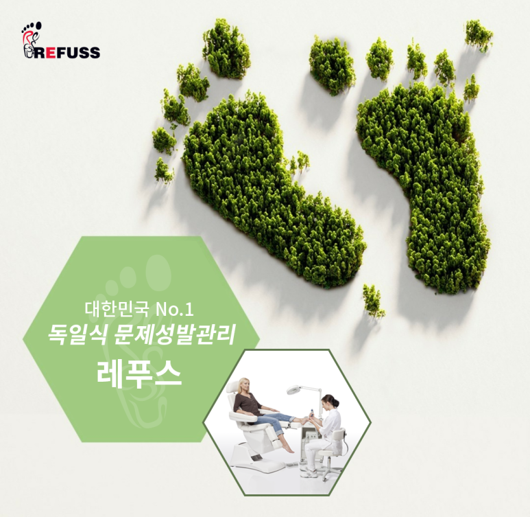 레푸스 이미지