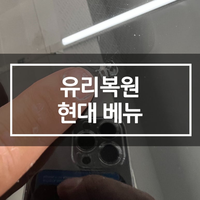 허덴트토탈카케어 이미지