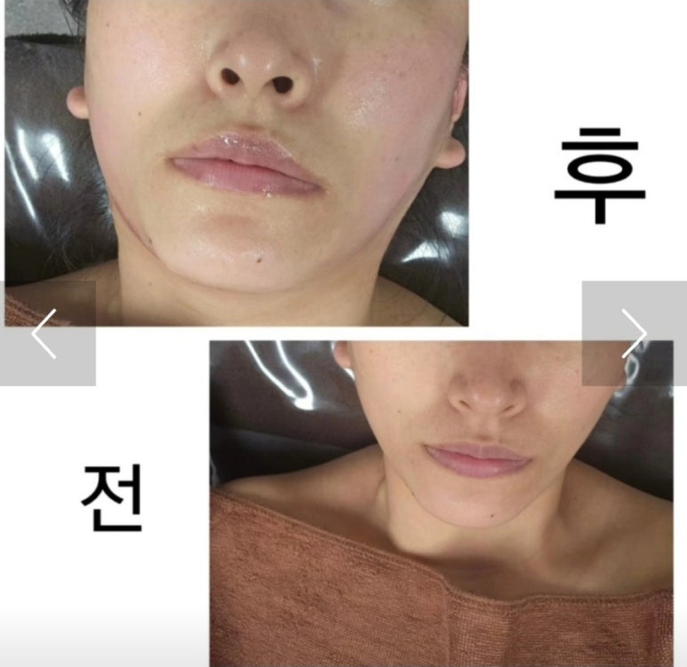 오늘은밝은피부 이미지