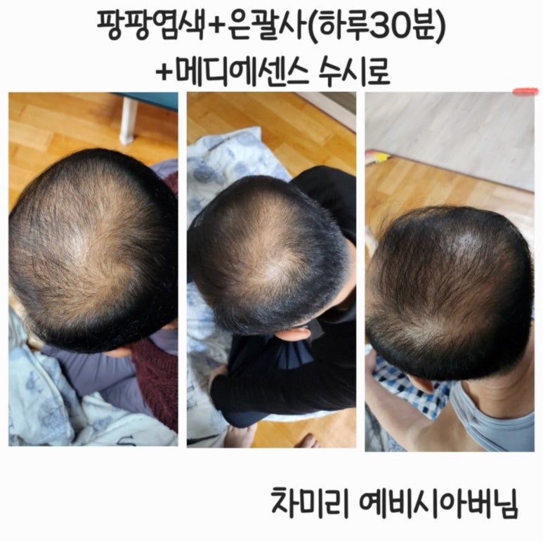 큐사랑머리염색 이미지
