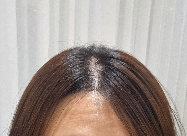 미담장토탈뷰티 이미지