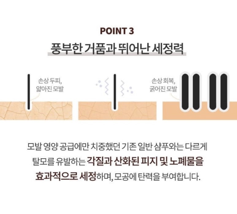 스캘프 이미지