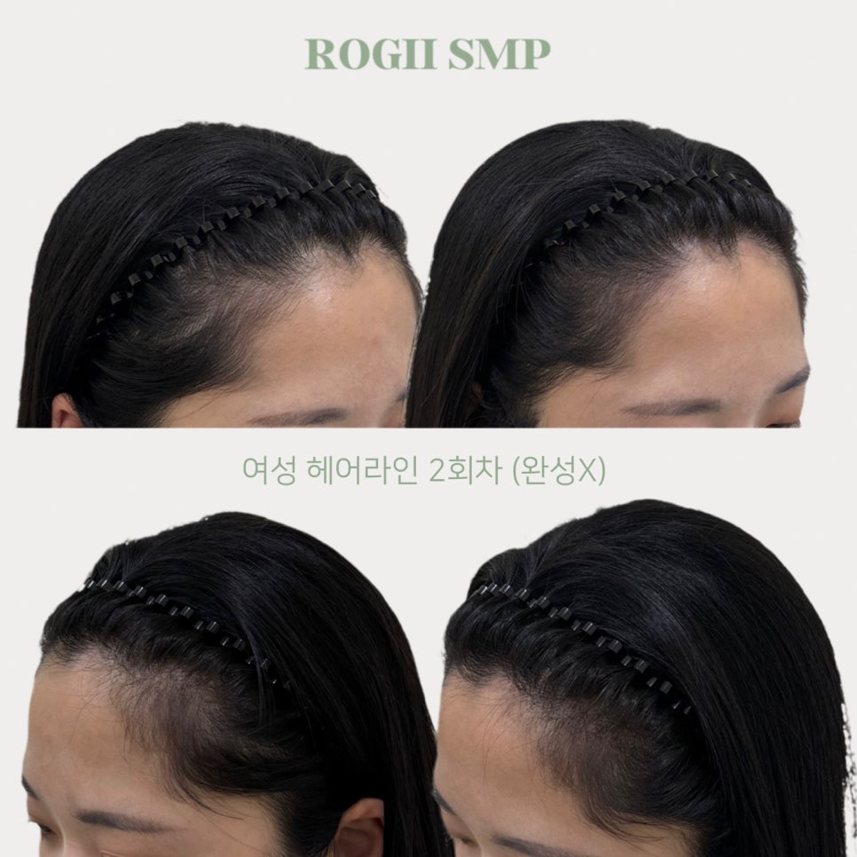 로기SMP 이미지