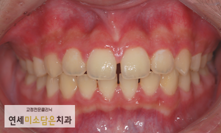 연세미소담은치과 이미지