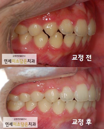연세미소담은치과 이미지