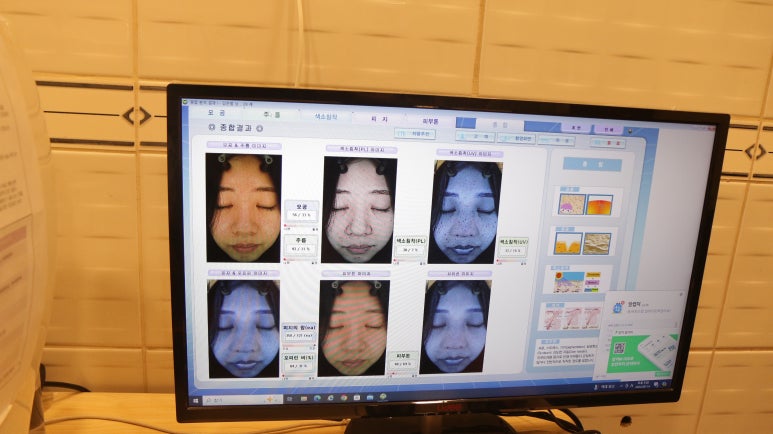 천안체형관리 이미지