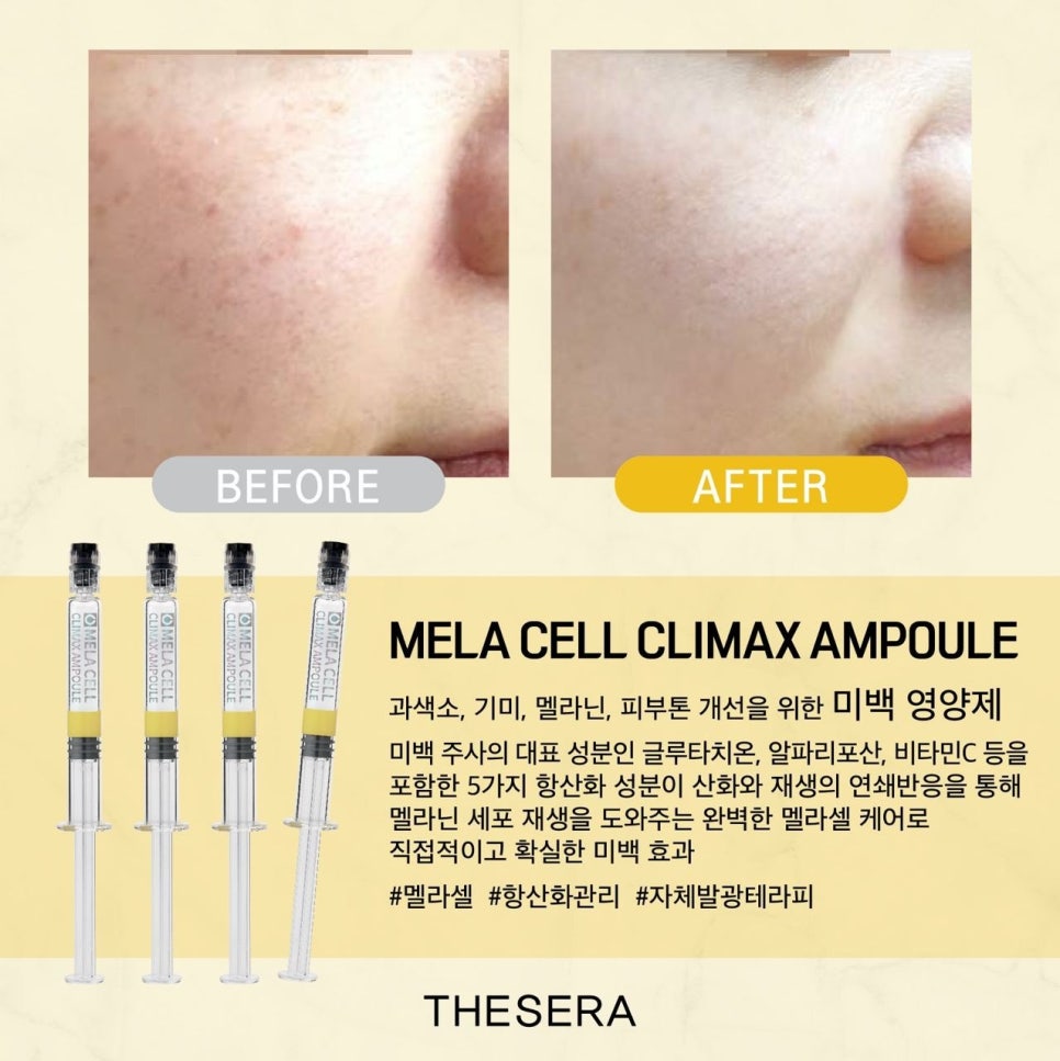 미앤미 피부관리 이미지