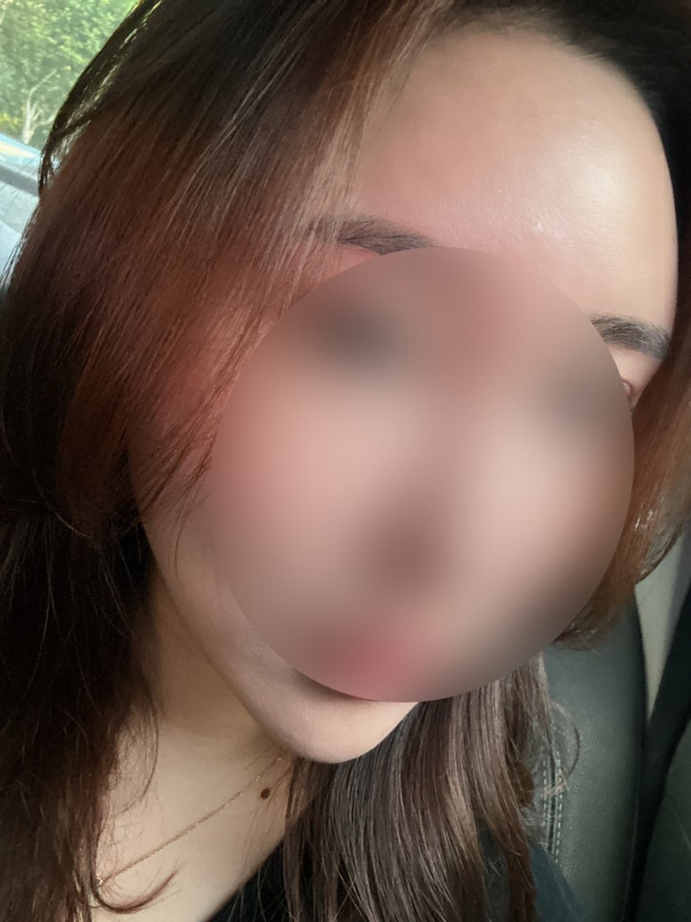 더바른테라피 이미지