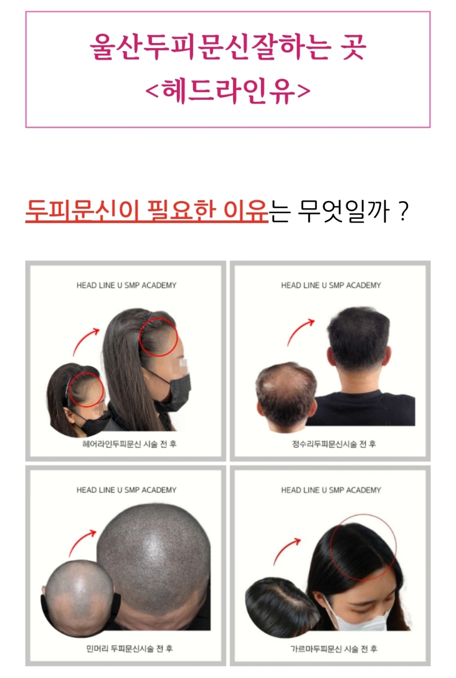 헤드라인유 이미지