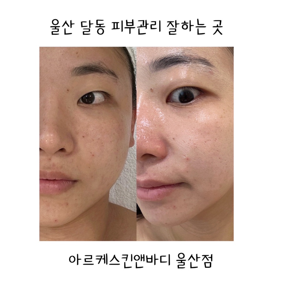 아르케스킨앤바디 울산점 이미지
