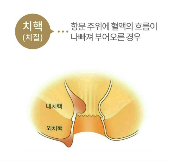 유항외과 이미지