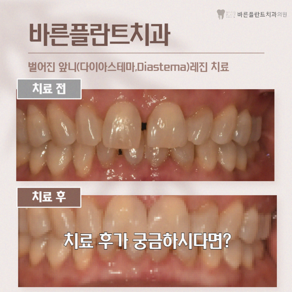 서울바른정치과의원 이미지