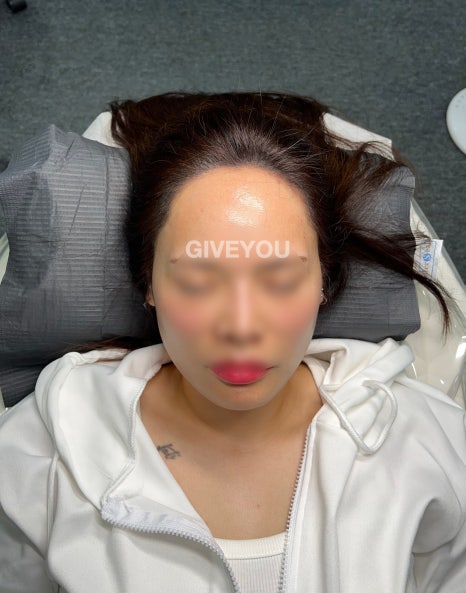 장헤어라인 이미지