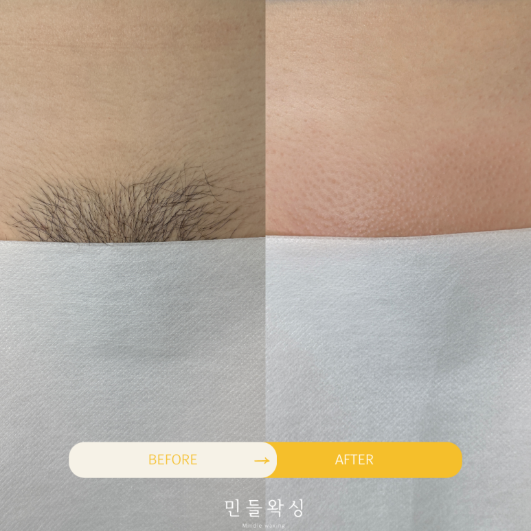민들왁싱 이미지