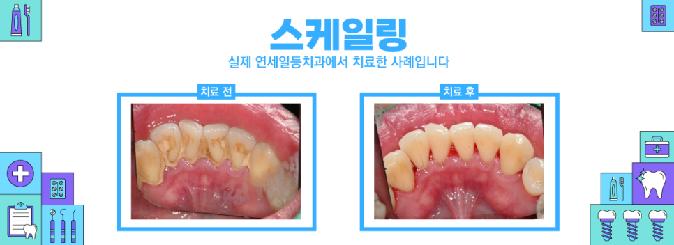 연세일등치과 이미지