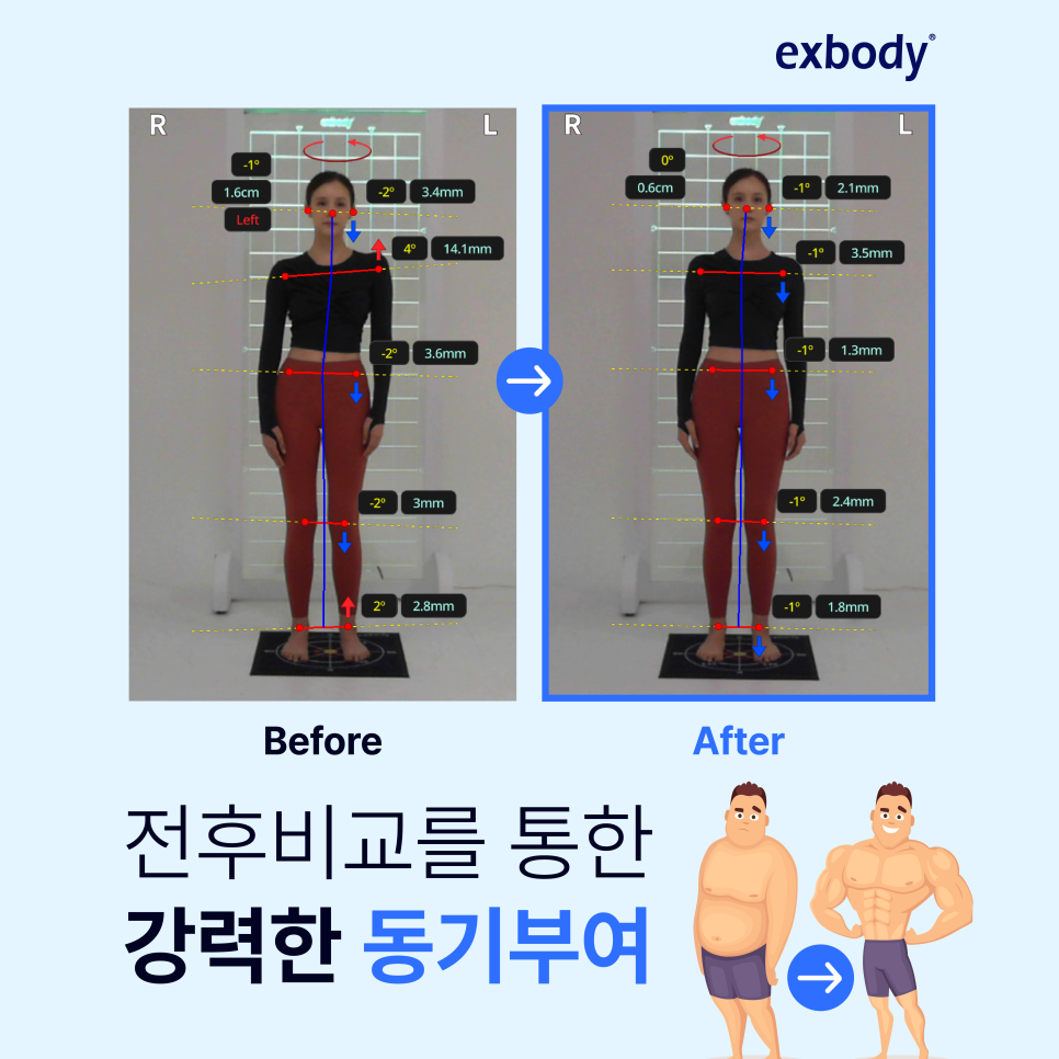 엑스바디 이미지