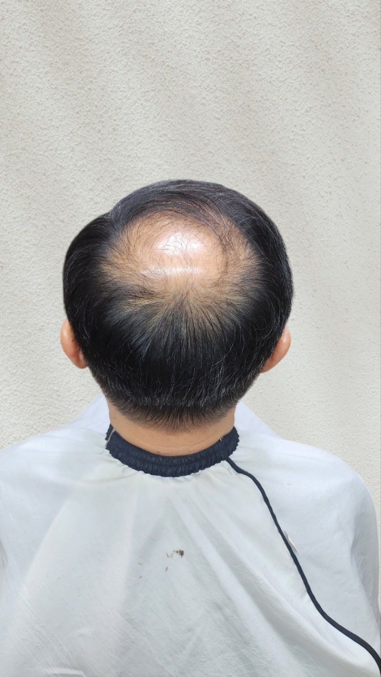 민재가발 이미지