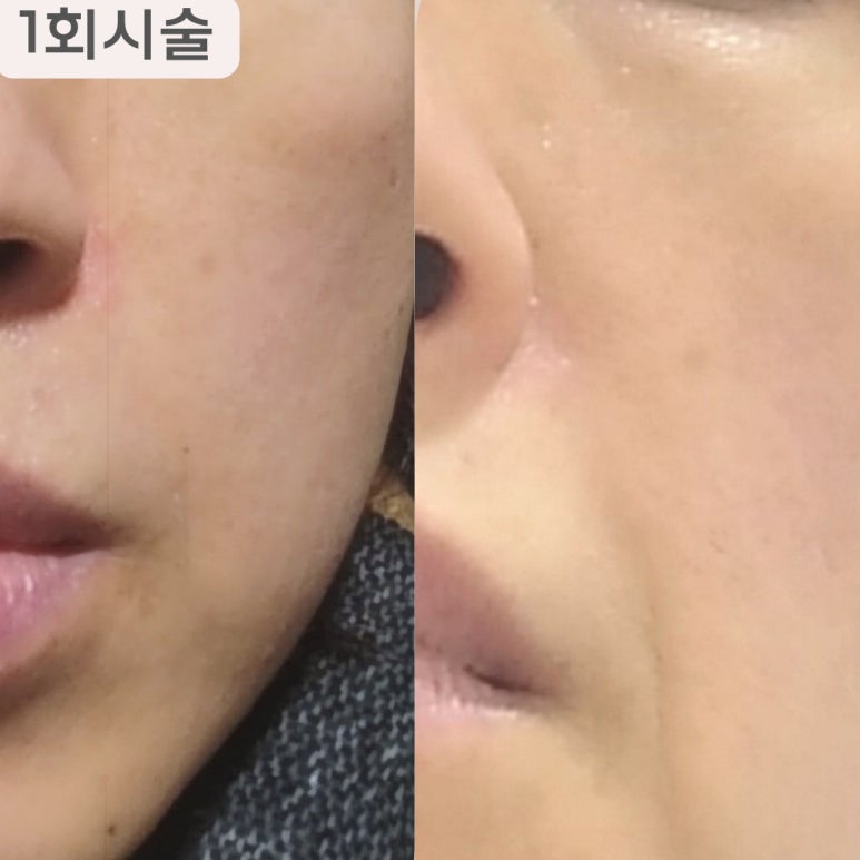 비비테라 이미지