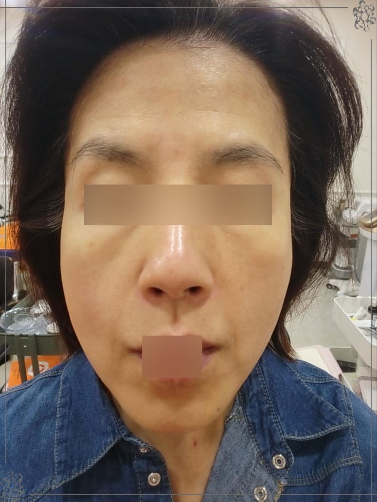 테라톡스 이미지