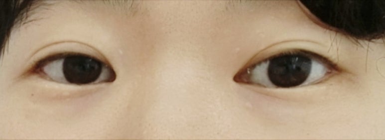 뽀글뽀글&눈썹 이미지