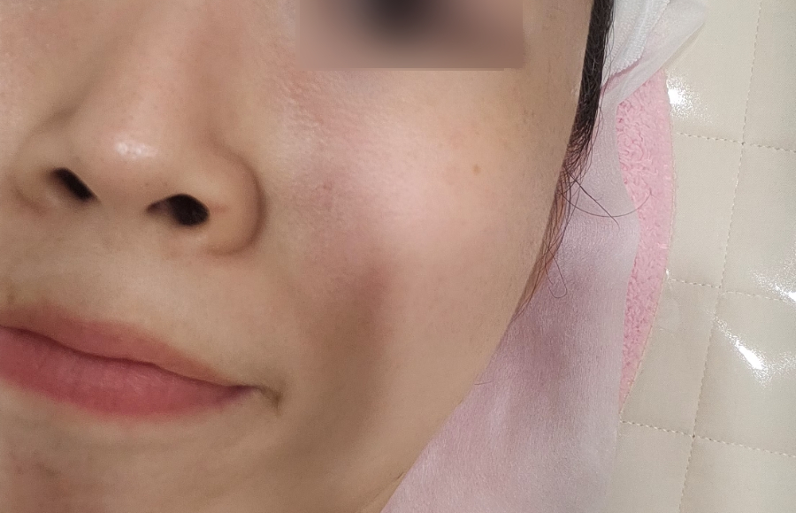 예쁘리 이미지
