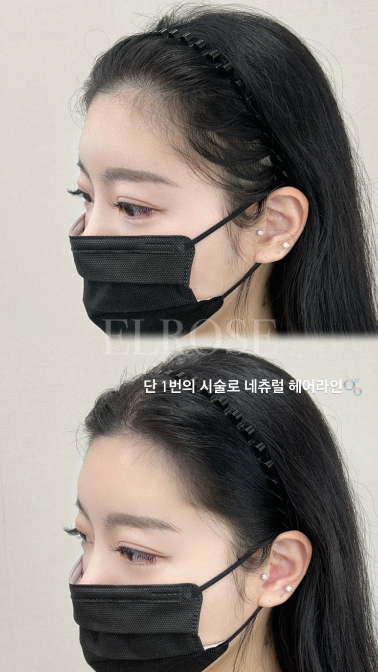 보강네츄럴 이미지