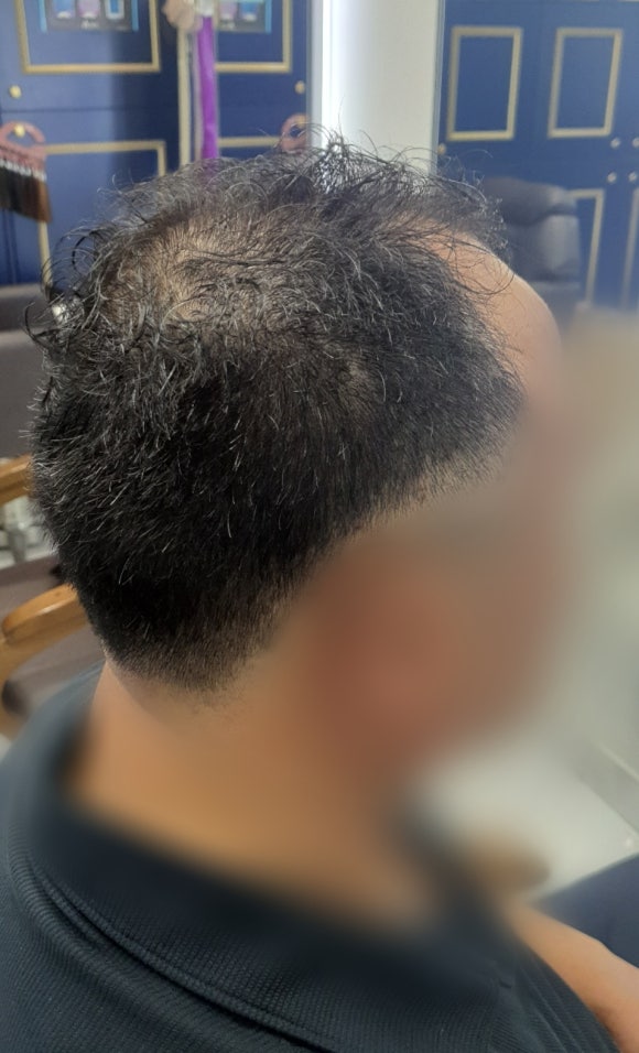 화성미용실김호증모가발 이미지