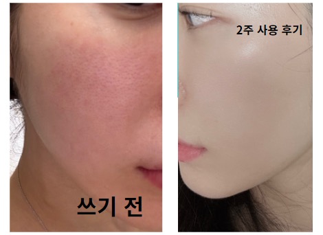 찐태닝 이미지