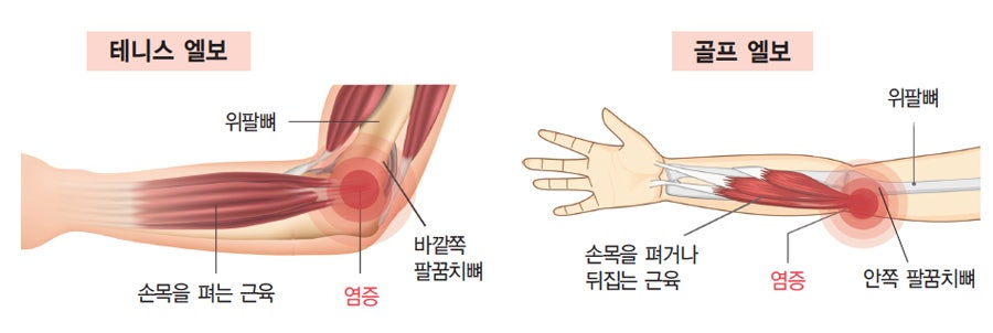 핑샵 이미지