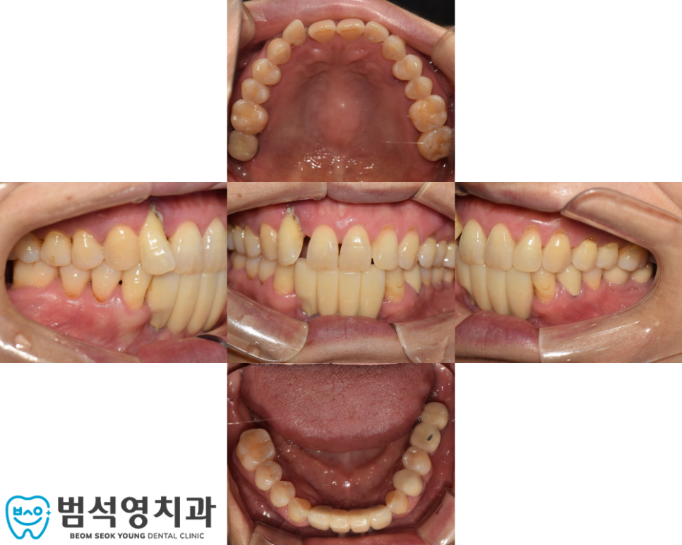 범석영치과 이미지
