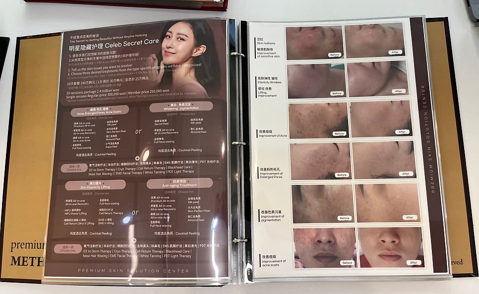 미더베스트 홍대점 이미지