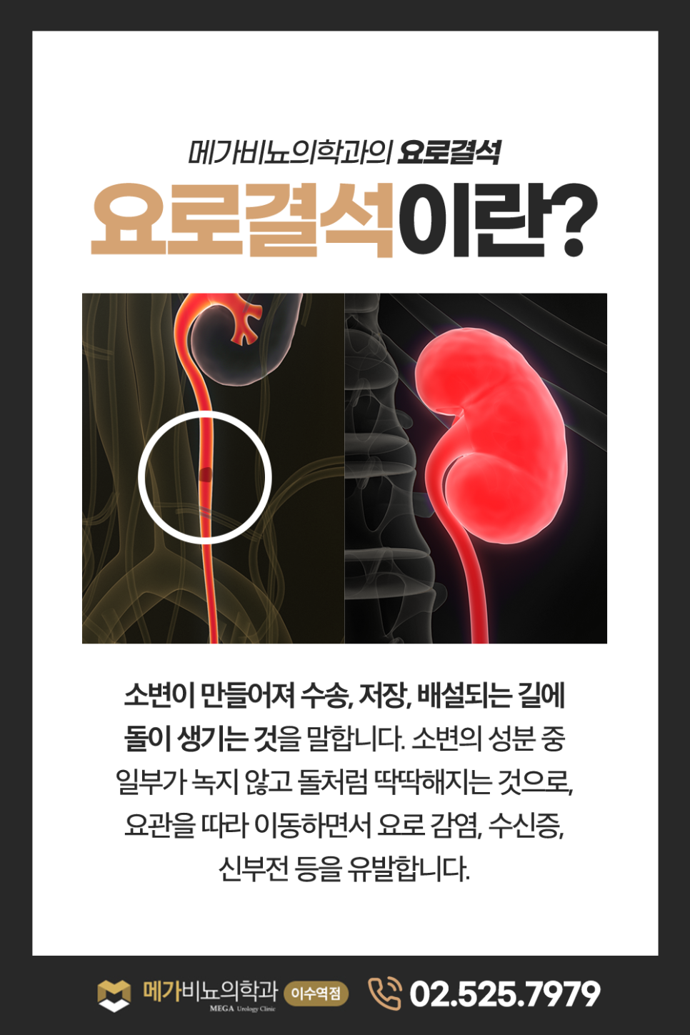 서비뇨기과 이미지