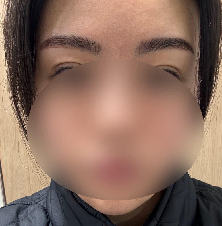 래쉬더로즈 이미지