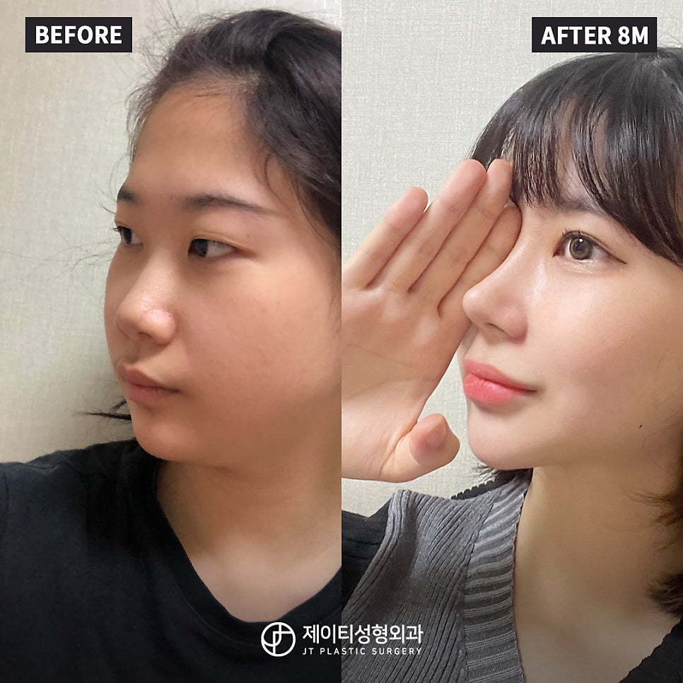 예쁨의정석의원 이미지