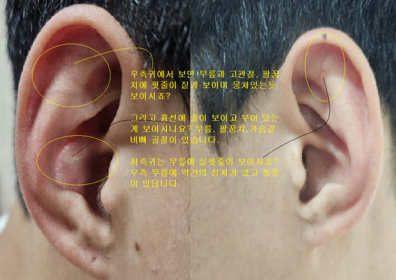 국제이침협회 이미지