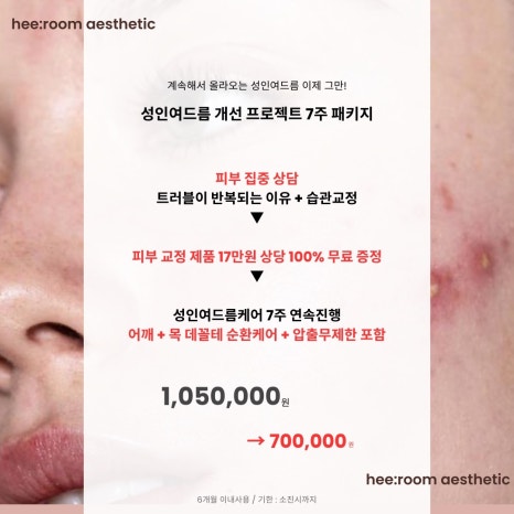 희룸 이미지