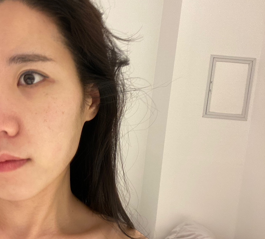 레스테틱광교 이미지