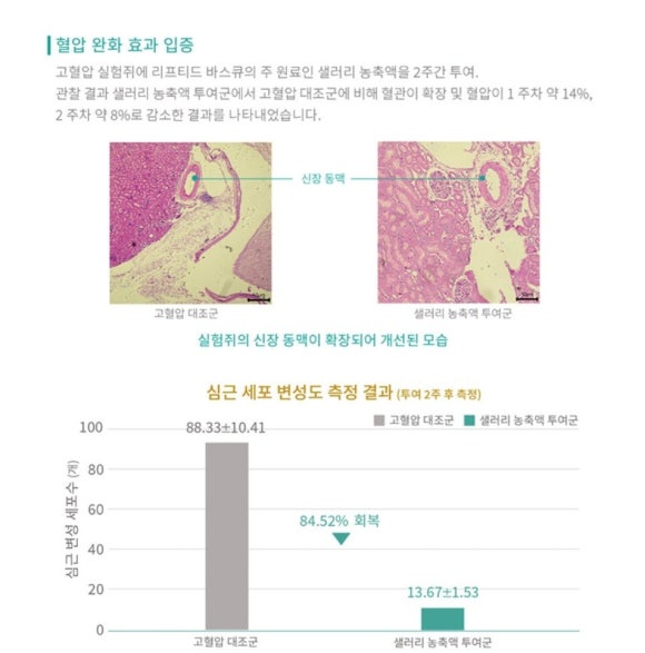 리프티드 이미지