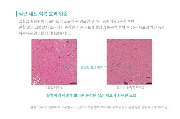 리프티드 이미지