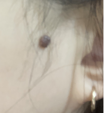 나비피부과의원 이미지
