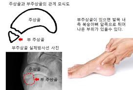 발올림 이미지