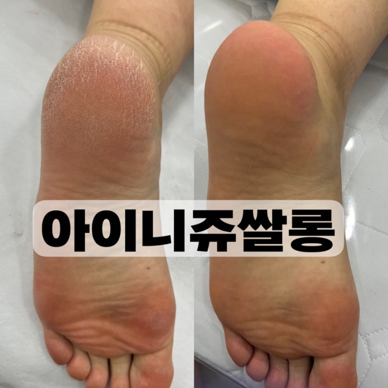 아이니쥬쌀롱 이미지